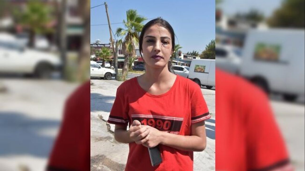 Eski eşinin yüzüne şişe fırlattığı Beste: Ben artık bu durumdan kurtulmak istiyorum