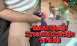 Sokak köpeği  2 yaşındaki çocuk yaraladı