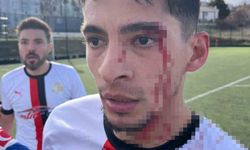 Maç sonrası saha içi savaş alanına döndü, 3 futbolcu hastanelik oldu