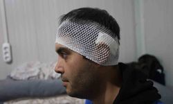 Bayram günü konteyneri delip geçen yorgun merminin kafasına isabet etmesiyle kabusu yaşadı