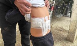 Saldırgan eşek evinin önünde oynayan 5 yaşındaki çocuğa kabusu yaşattı