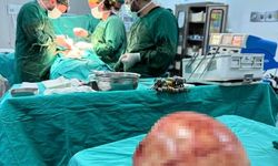 Van'da bir kadının karnından 35 santimetrelik dev kitle çıkarıldı
