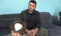 Yalova'daki komşu kavgasında bu kez 8 yaşındaki çocuğa taşlı saldırı