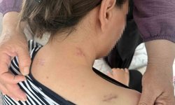 17 bıçak darbesi aldı, ölü numarasıyla kurtuldu, kocasının en ağır cezayı almasını istedi