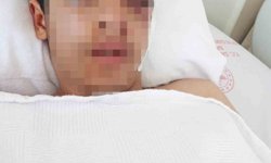 Akran zorbalığına bir yenisi eklendi: 15 yaşındaki çocuk muştayla öldüresiye dövüldü