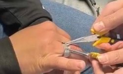 Batman'da parmağa sıkışan yüzük itfaiye ekiplerince çıkarıldı