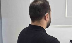 İşitme cihazı alırken dikkat edilmesi gerekenler