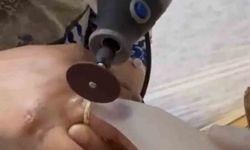 Kazada yaralanan kadının parmağına sıkışan yüzüğü itfaiye ekipleri çıkardı