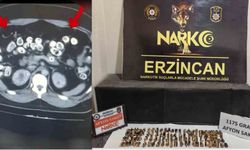 Erzincan'da uyuşturucuyu vücutlarında taşıyan 3 şüpheli yakalandı