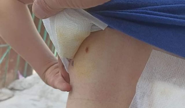 Diyarbakır’da 8 yaşındaki çocuk sokak köpeklerinin saldırısında yaralandı