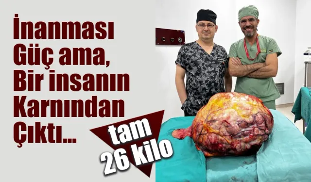 Karın ağrısı şikayeti ile gelen hastanın karnından 26 kilogramlık tümör çıktı