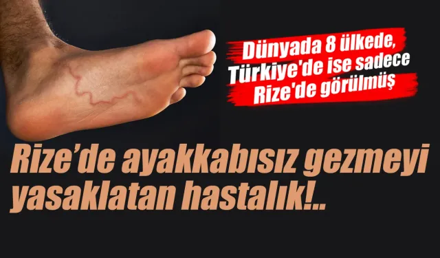 Rize'de ayakkabısız gezmeyi yasaklatan hastalık!..