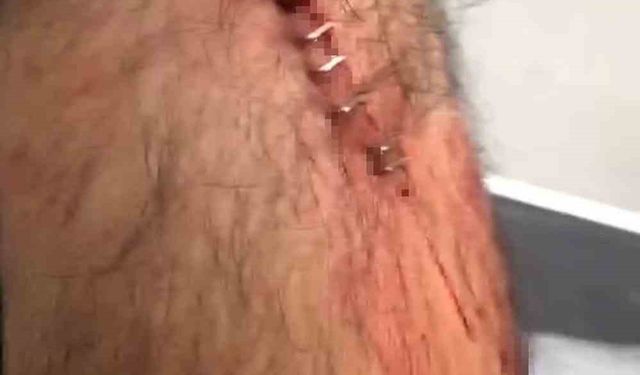 Şanlıurfa’da görev yapan öğretmene sokak ortasında jiletli saldırı