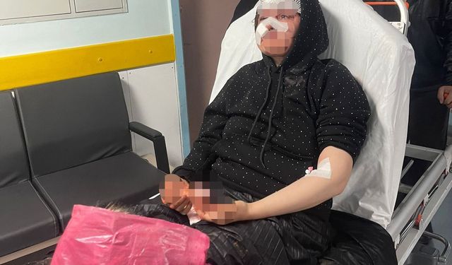 Boşanmak isteyen kadın eşi tarafından öldüresiye darp edildi