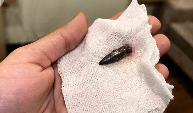 Gazzeli Awad, 1,5 yıldır kafasında taşıdığı mermiden Türk yardımseverlerin desteğiyle kurtuldu