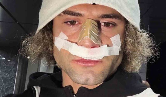 Elazığspor'da Fuat Bavuk'un burnu kırıldı