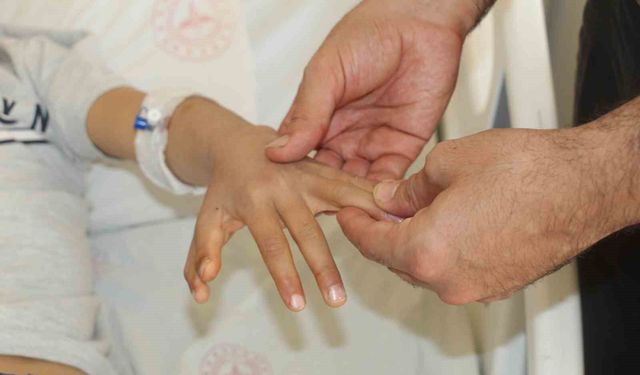 Şırnak'ta yapışık parmaklı iki kardeş ameliyatla sağlıklarına kavuştu