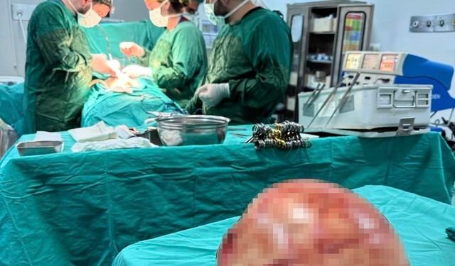 Van'da bir kadının karnından 35 santimetrelik dev kitle çıkarıldı