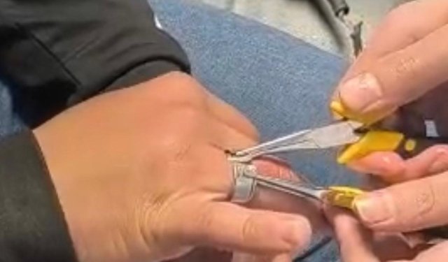 Batman'da parmağa sıkışan yüzük itfaiye ekiplerince çıkarıldı