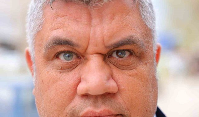 Kahramanmaraşlı adam 3 renkli gözleriyle görenlerin ilgisini çekiyor