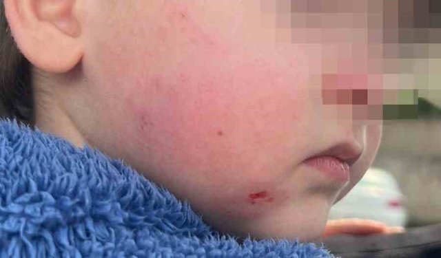 Kreşe bıraktığı çocuğunu darp edilmiş halde aldı