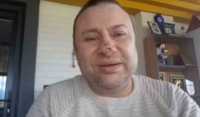 Pitbull saldırısına uğrayan Onur Akay o anları anlattı: 'Ben ölümden döndüm'