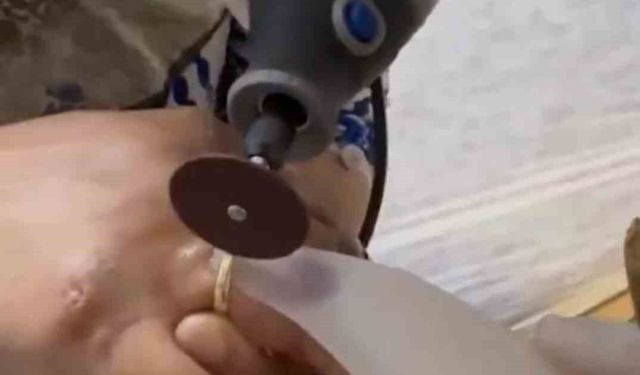 Kazada yaralanan kadının parmağına sıkışan yüzüğü itfaiye ekipleri çıkardı