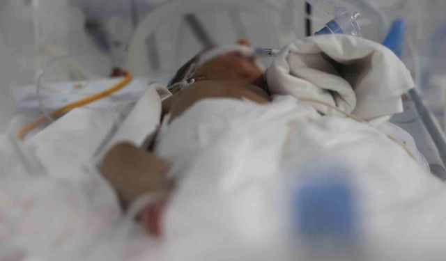 Bağırsak ameliyatıyla sağlığına kavuşan bin 300 gramlık Suriyeli prematüre bebeğin babasından Türkiye'ye övgü dolu sözler