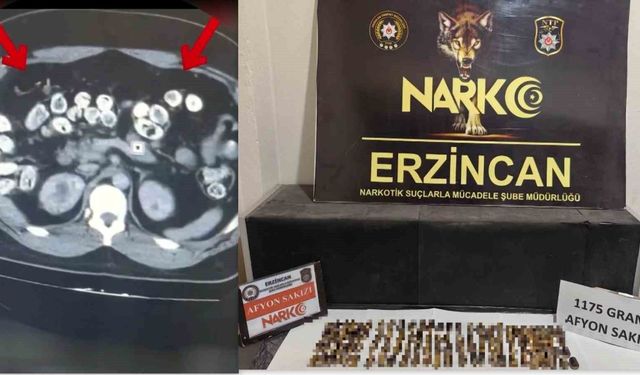 Erzincan'da uyuşturucuyu vücutlarında taşıyan 3 şüpheli yakalandı