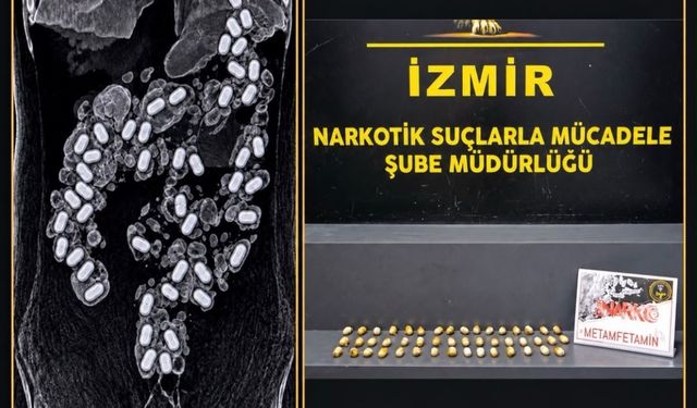 Havalimanında yakalandı: Midesinden 47 kapsül uyuşturucu çıktı