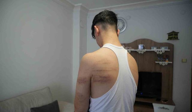 Niğde'de 15 yaşındaki berber çırağına darp iddiası: Önce dövdü, sonra temizlik yaptırdı