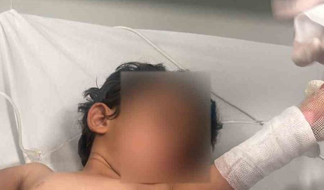Şırnak'ta 3 yaşındaki kızın üzerine kaynar su döküldü